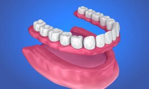 dental_dentures