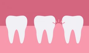 dental_peridontal_therapy dental_peridontal_therapy