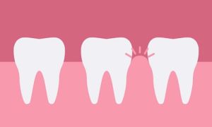 dental_peridontal_therapy